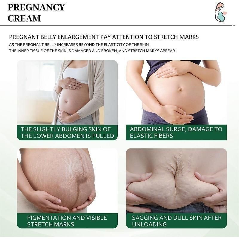 Bejoy Pregnancy Scars, Acne Remove Cream (Pack of 2)