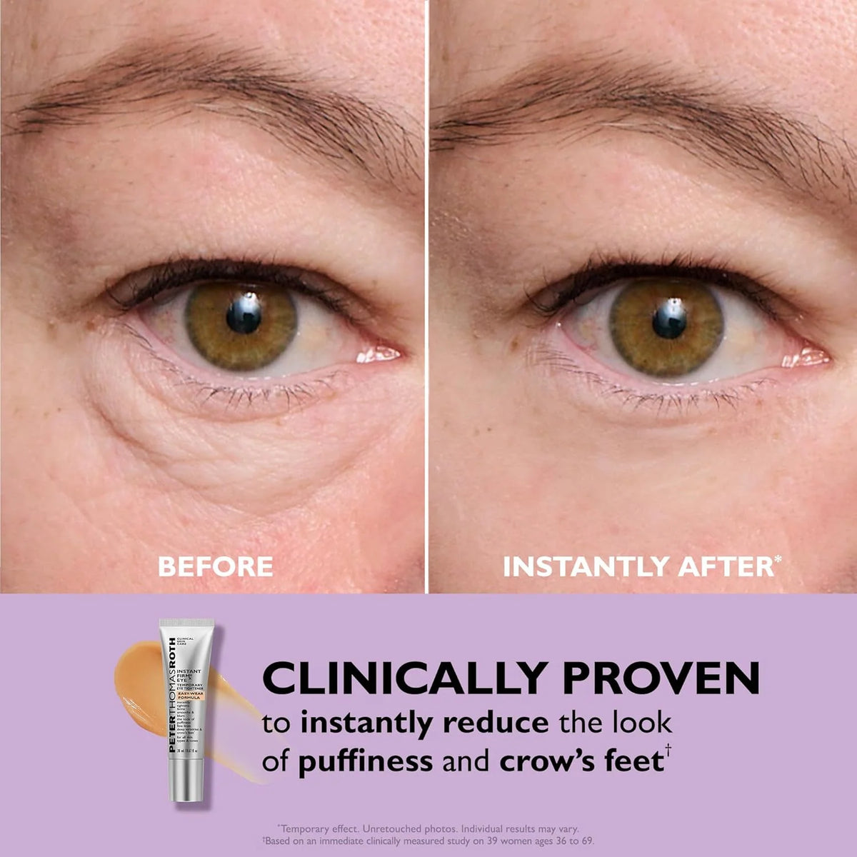 Peter Thomas Roth Instant FIRMx Eye Tightener (Buy 1 Get 1 Free)