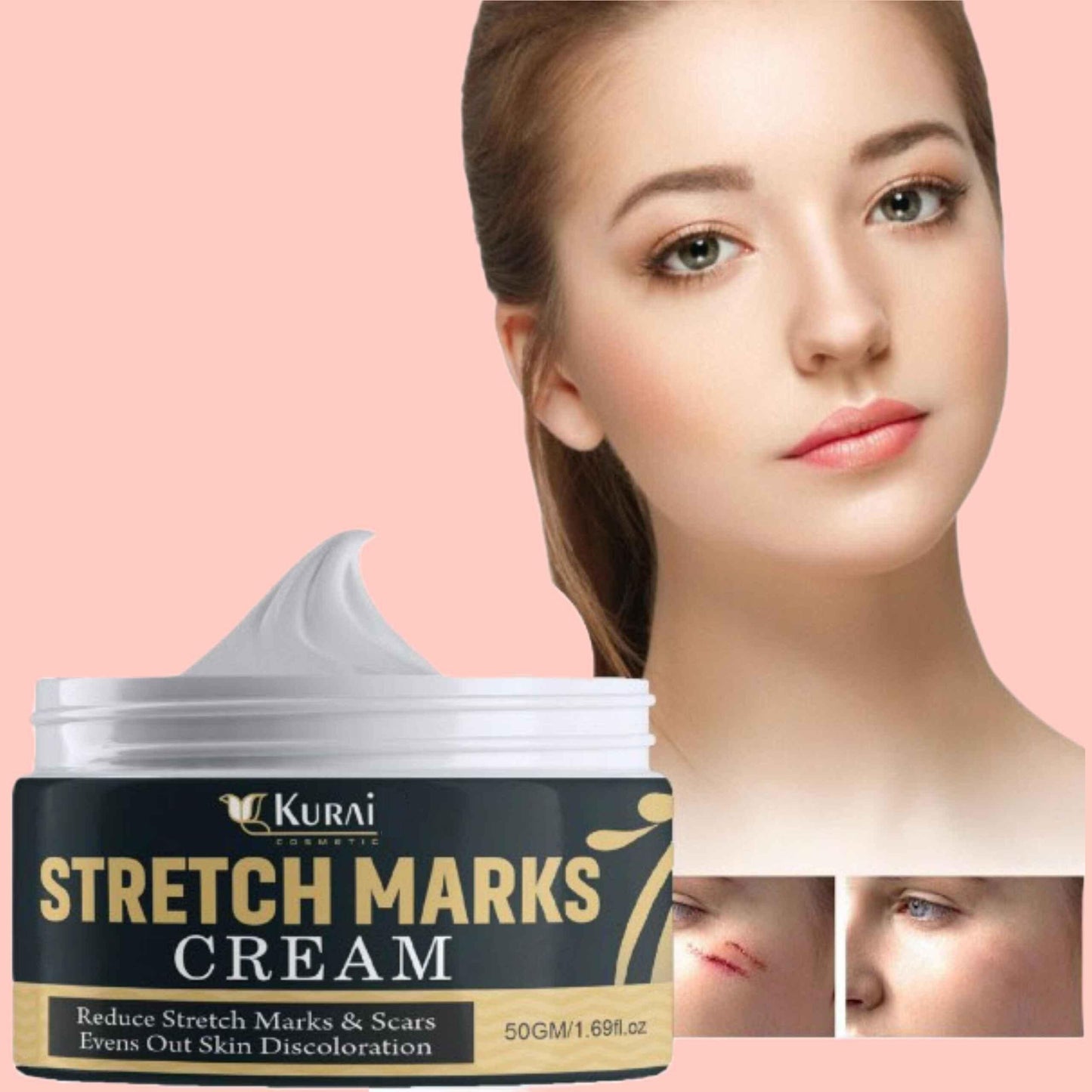 Bejoy Pregnancy Scars, Acne Remove Cream (Pack of 2)