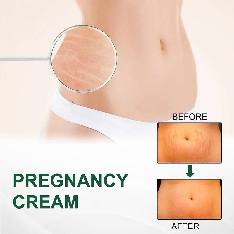 Bejoy Pregnancy Scars, Acne Remove Cream (Pack of 2)