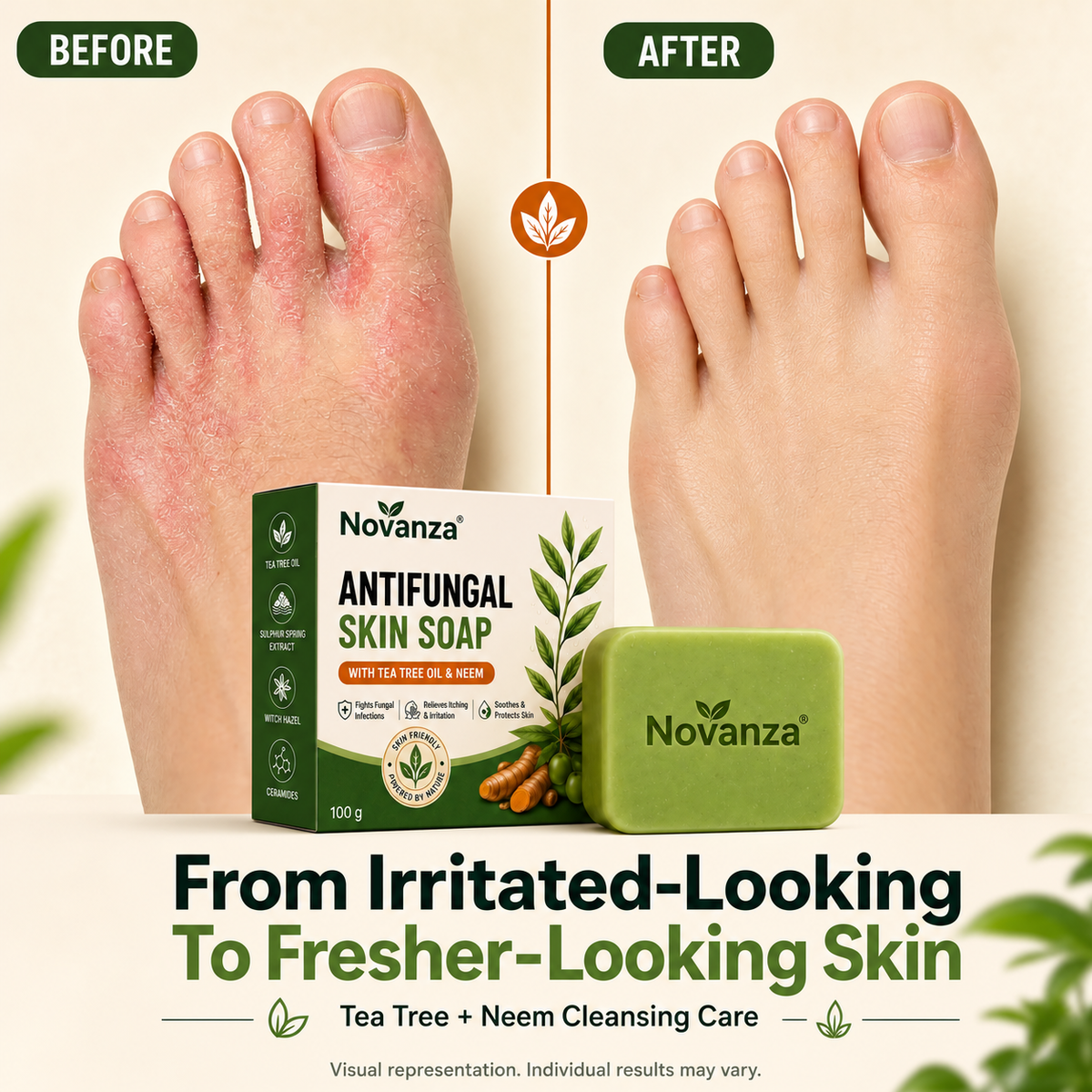 Antifungal Skin Soap