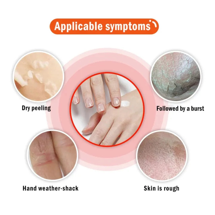 Anti Crack Foot Cream