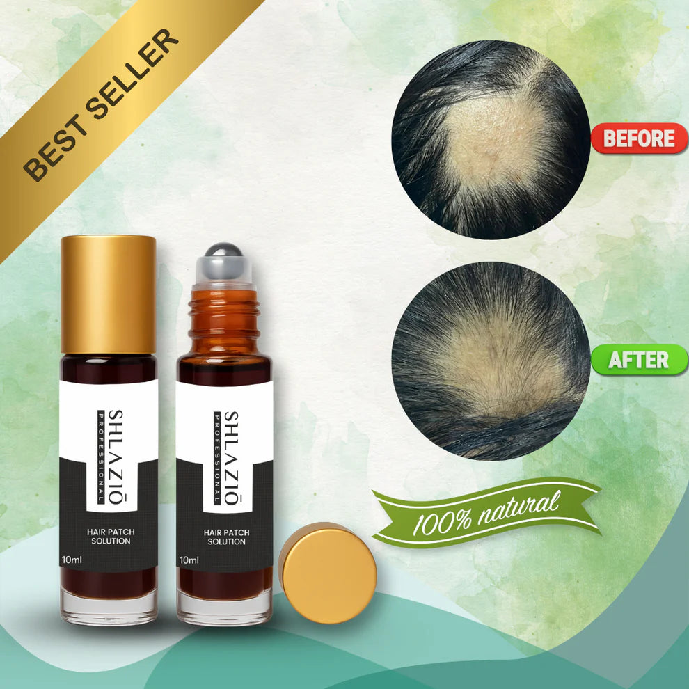 Alopecia Hair Patch Solution (45 ML ROLL-ON)