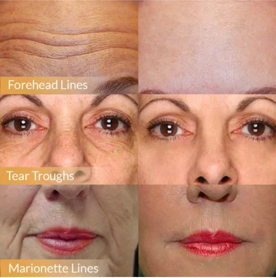 POLYPEPTIDE FIRMING FULL FACE CREAM (️‍🔥Buy 1 Get 1 Free️‍🔥)