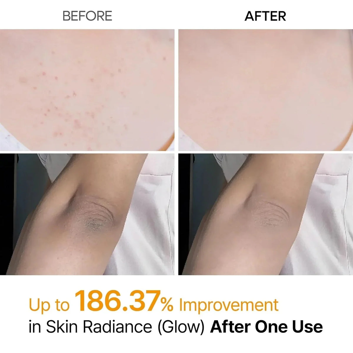 Dr. Melaxin Kojic Acid Turmeric Spray (Buy 1 Get 1 Free)