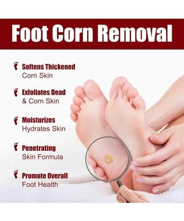 Feet Corn Removal Serum 30ml (Buy 1 Get 1 Free)