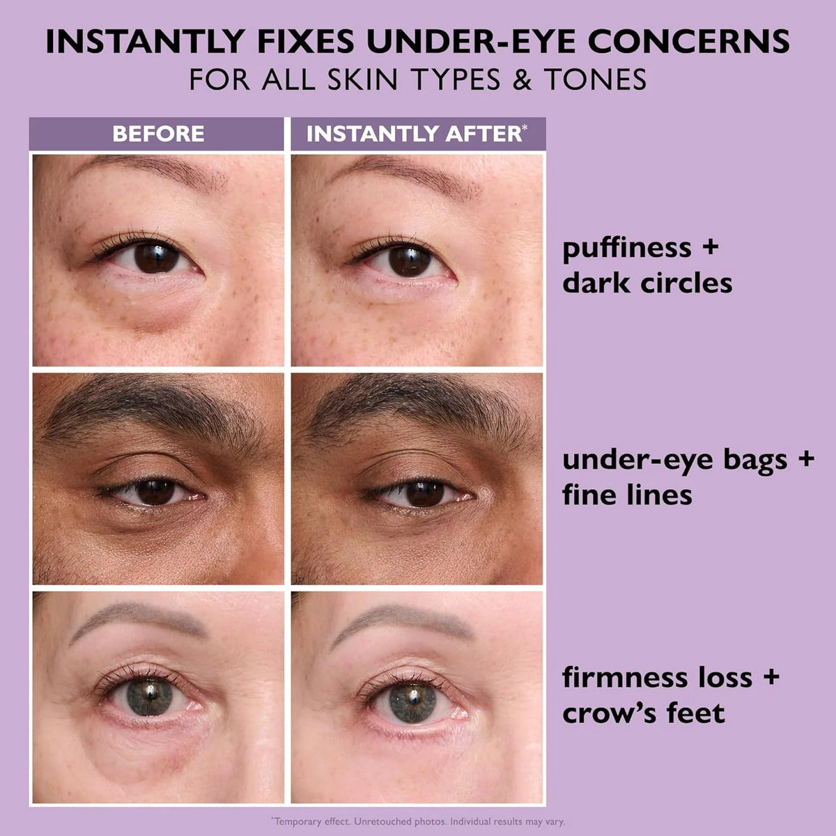 Peter Thomas Roth Instant FIRMx Eye Tightener (Buy 1 Get 1 Free)