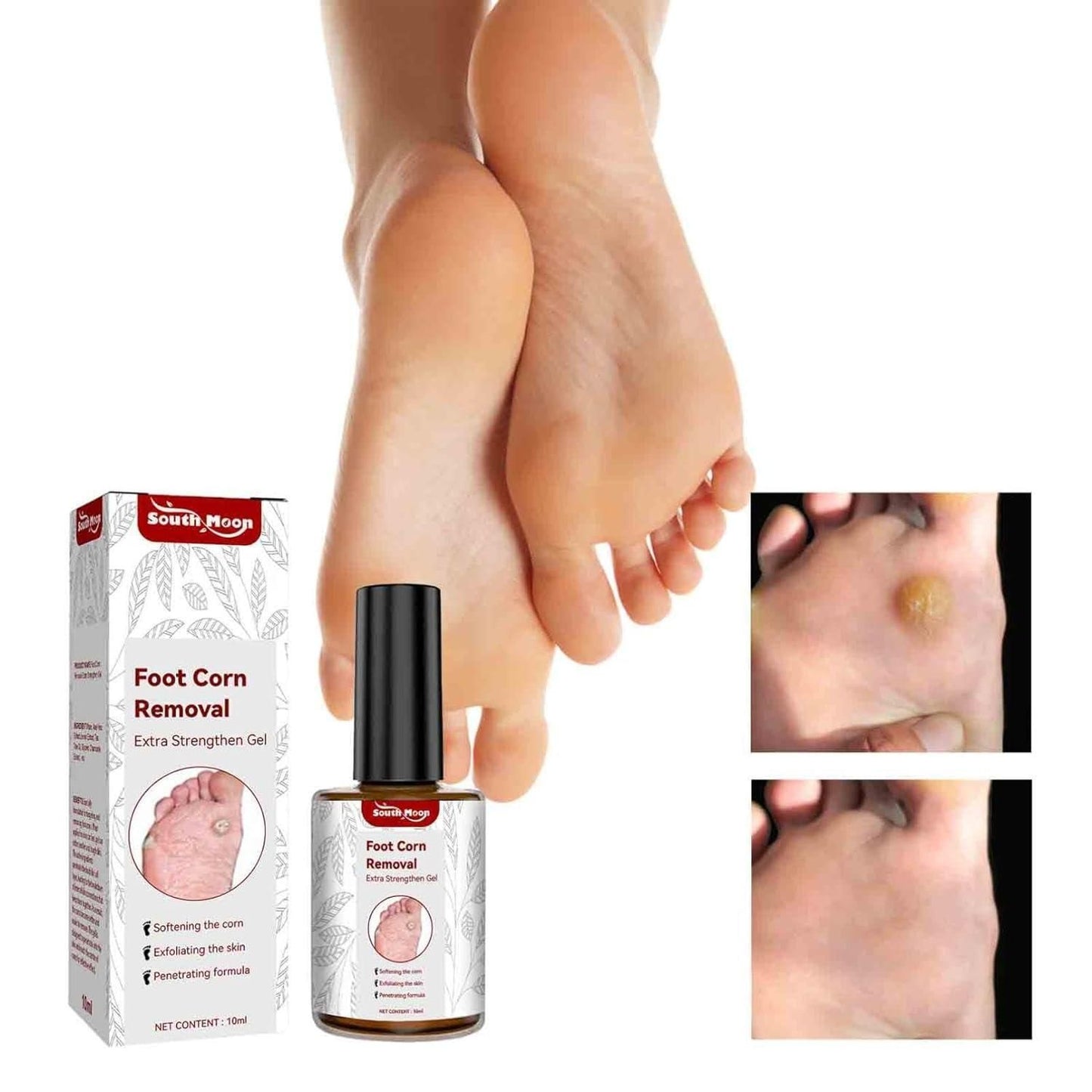 Feet Corn Removal Serum 30ml (Buy 1 Get 1 Free)