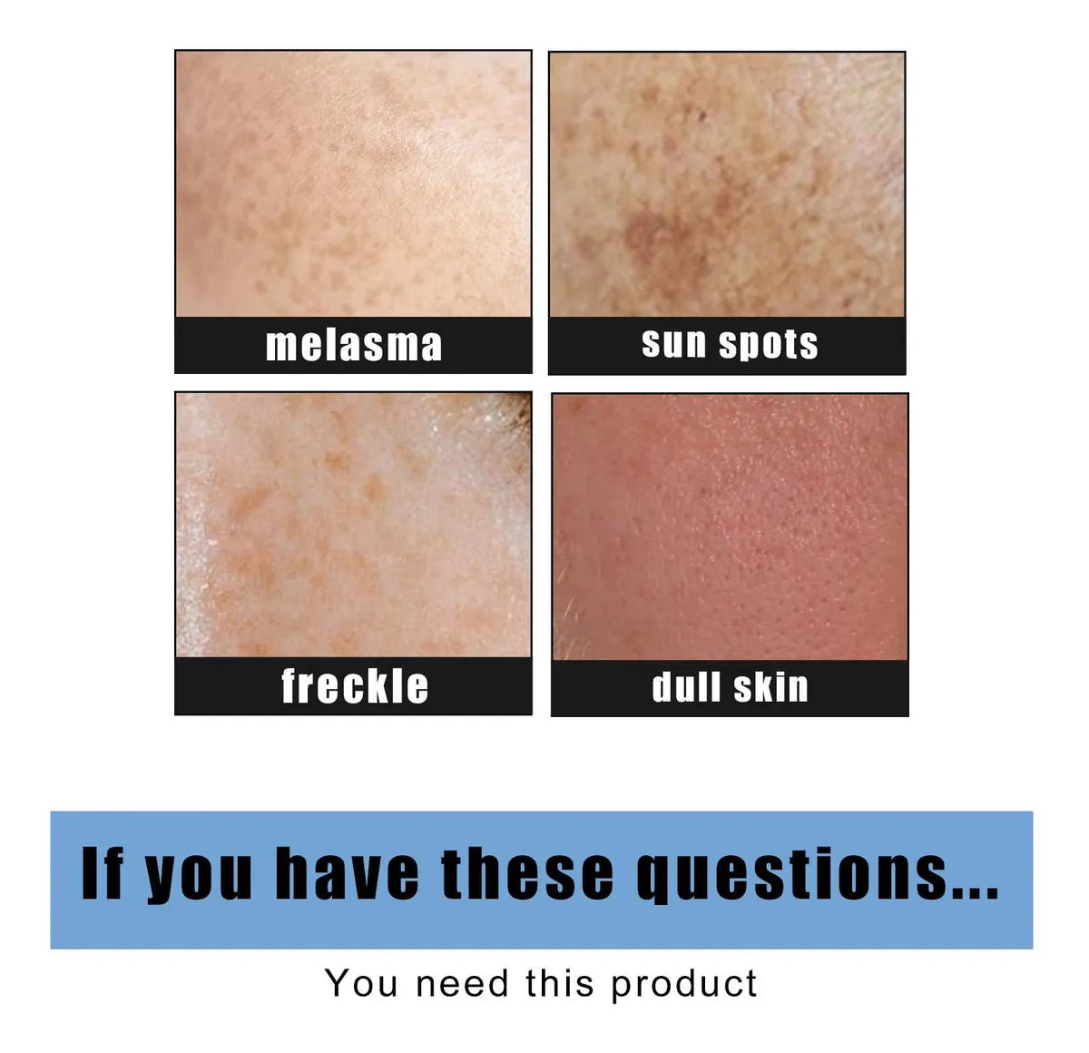 Dark Spot Corrector Frackle Cream