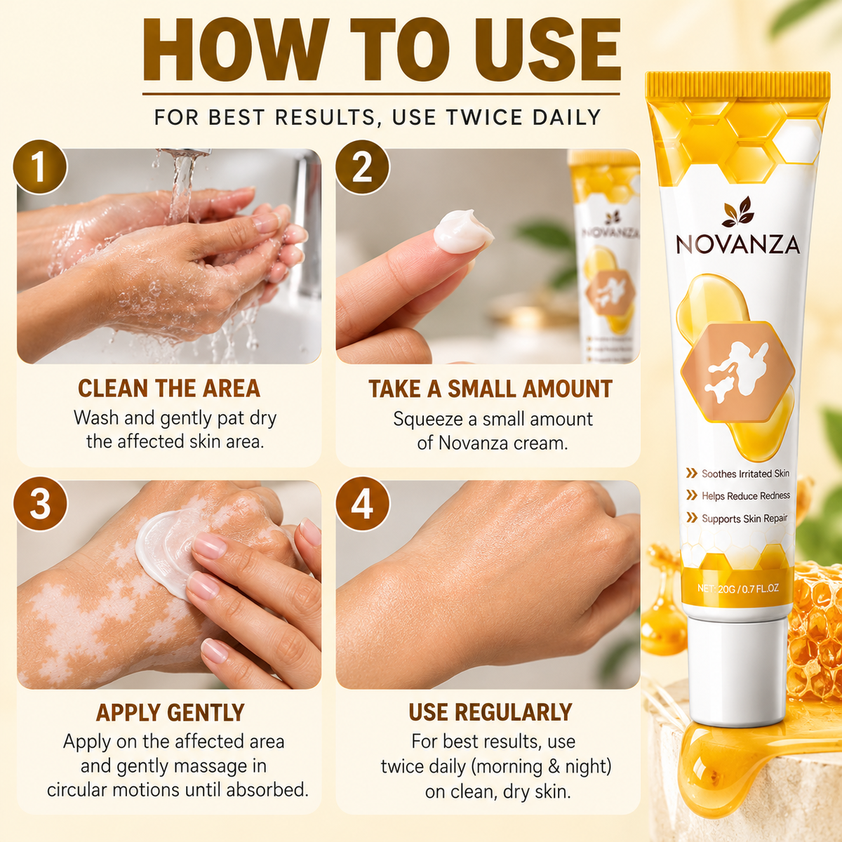 Novanza's Vitiligo Cream (Buy 1 Get 1 Free)