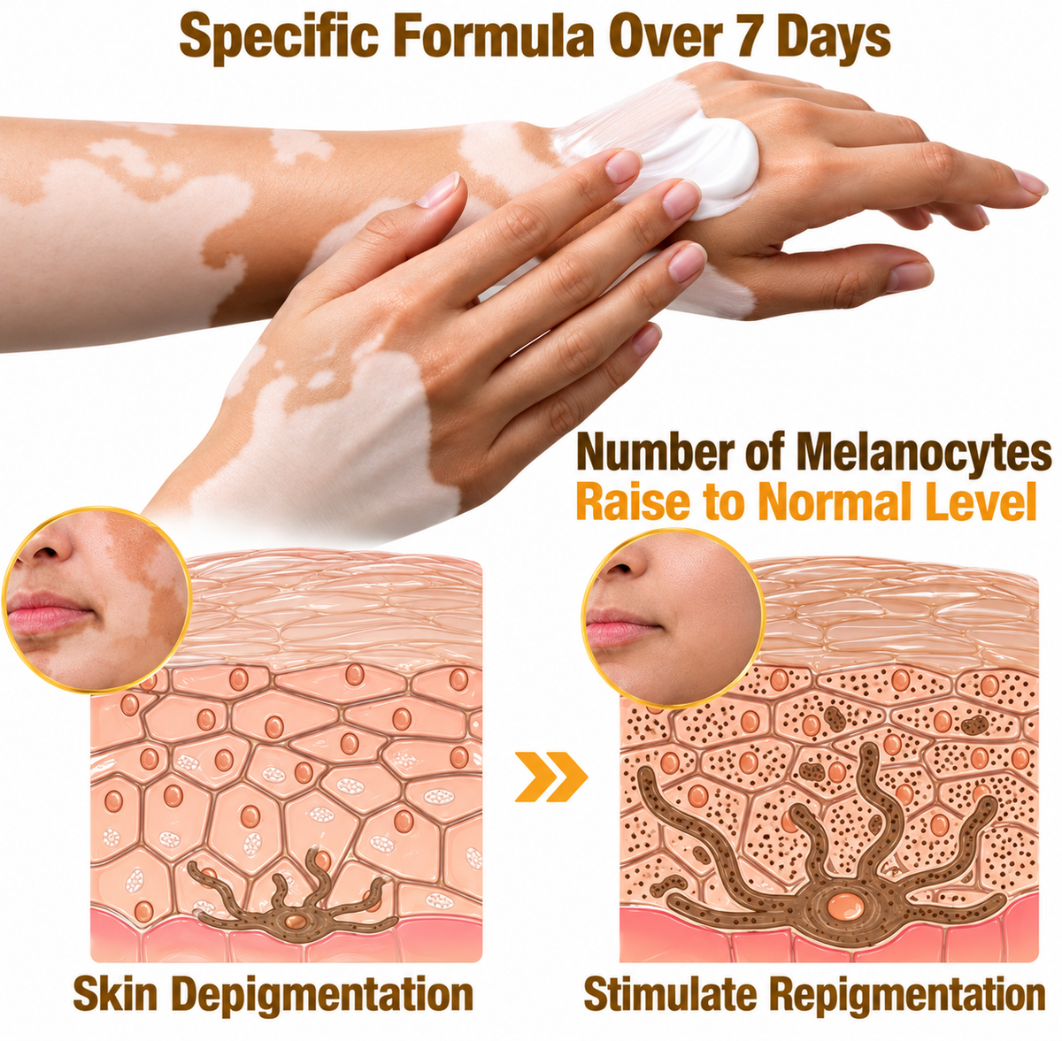 Novanza's Vitiligo Cream (Buy 1 Get 1 Free)