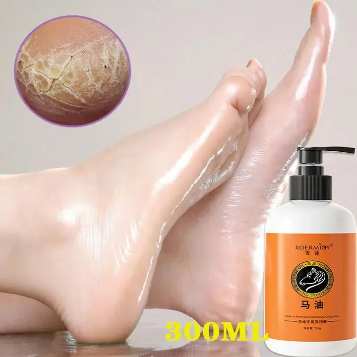 Anti Crack Foot Cream