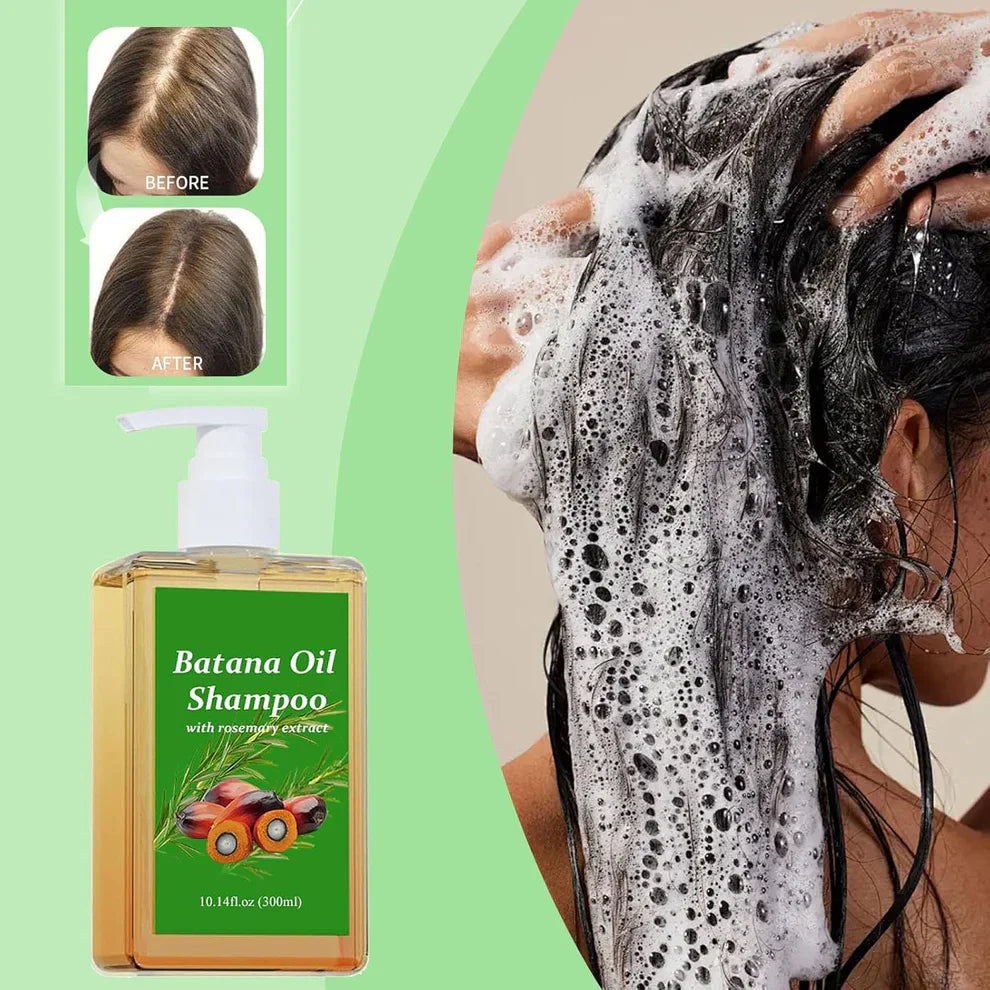 Batana Oil Shampoo for Hair Growth with Rosemary Extract (✨Buy 1 Get 1 Free✨)🌱