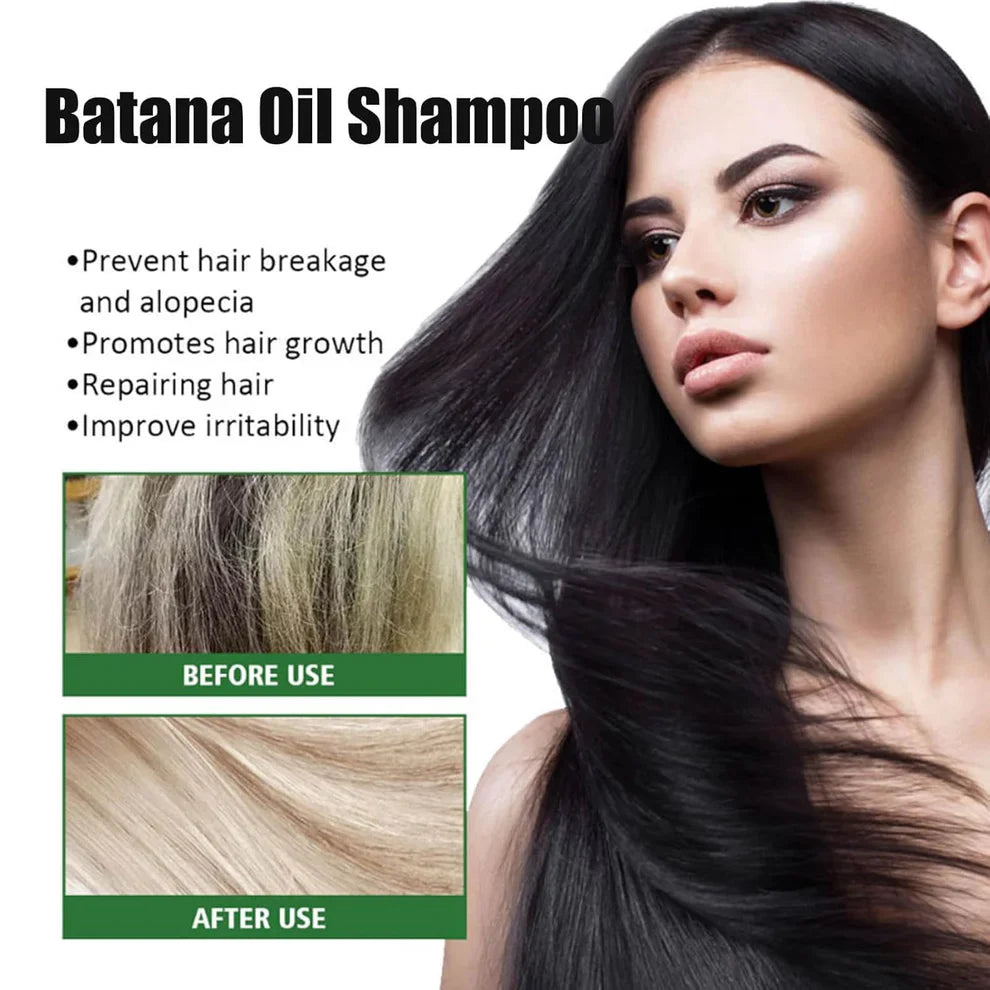Batana Oil Shampoo for Hair Growth with Rosemary Extract (✨Buy 1 Get 1 Free✨)🌱