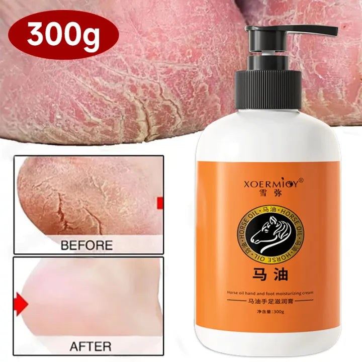 Anti Crack Foot Cream