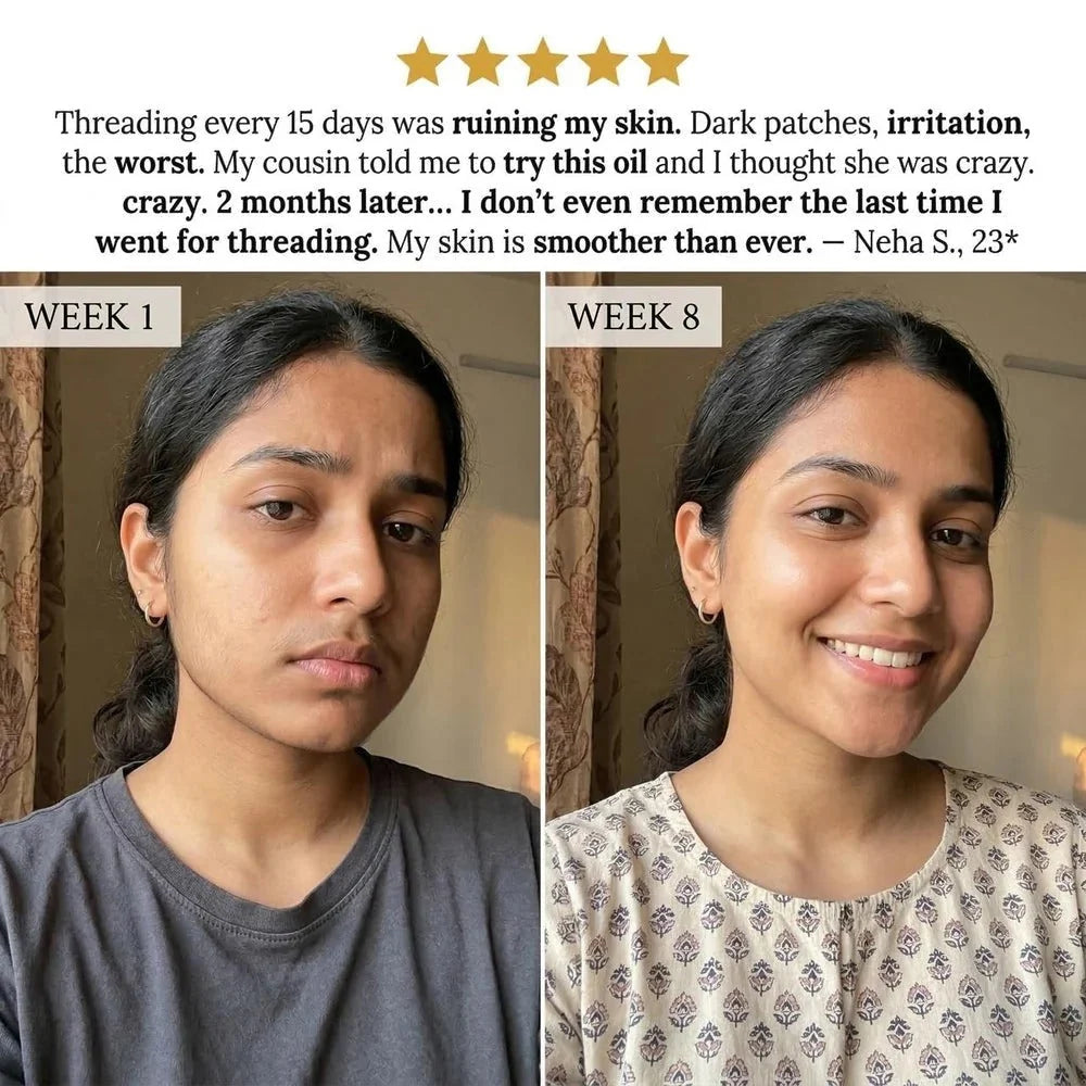 Layali Follicle Rotundus Oil for Hair Removal |🔥Buy 1 Get 1 Free🔥🔥