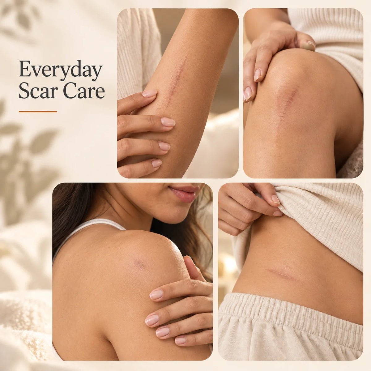 Scar Removal Cream (Buy 1 Get 1 Free)