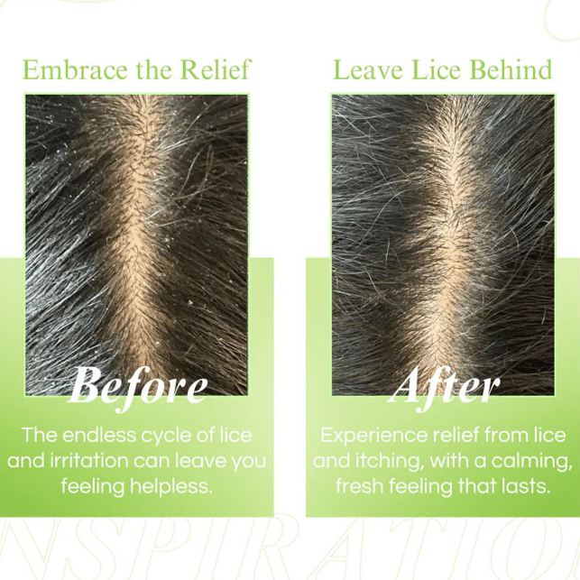 BT Boericke & Tafel B&T Arnica Shampoo (Buy 1 Get 1 Free)